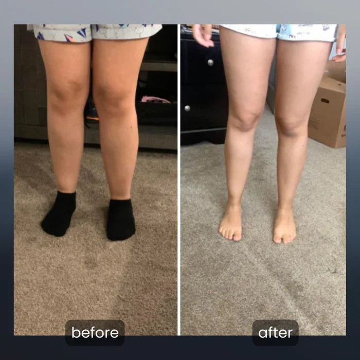 Leg Massager with Heat – Relief for Tired & Sore Legs